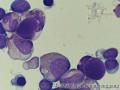 Bone marrow smear - 1图3