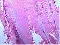 右大腿肿物-补充低倍照片图49