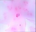 请教  乳头溢液  H-E染色图6