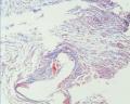 分享masson染色图4