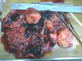 腹腔肿块图17
