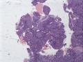 22岁子宫内膜，请教高手图1