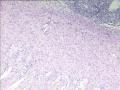小肠一个有意思的病例！图7