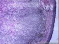 腰部肿物待诊图2