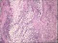 急急急。这是什么病图10