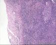 48岁男性,HE求教！颌下肿物3*2*2CM质硬，腮腺 肿物9*5*4CM 。原来冰冻求教，现将腮腺切片图1-29，图30以后腮腺部淋巴结图30