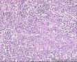 48岁男性,HE求教！颌下肿物3*2*2CM质硬，腮腺 肿物9*5*4CM 。原来冰冻求教，现将腮腺切片图1-29，图30以后腮腺部淋巴结图17