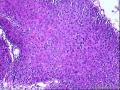 外阴赘生物图4