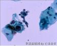 体检，42岁，请大家欣赏并讨论图9