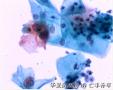 体检，42岁，请大家欣赏并讨论图4