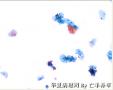 体检，42岁，请大家欣赏并讨论图6