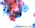 体检，42岁，请大家欣赏并讨论图11