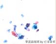 体检，42岁，请大家欣赏并讨论图21