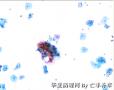 体检，42岁，请大家欣赏并讨论图17