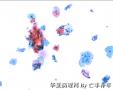 体检，42岁，请大家欣赏并讨论图10