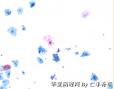 体检，42岁，请大家欣赏并讨论图1