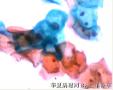HPV感染图2