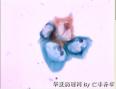 HPV感染图3