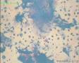 50岁体检病人（背景是否为肿瘤素质？）图8