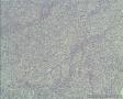 2012年第40期——右颈部淋巴结图5