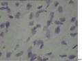 新生儿 女 牙龈黄豆大小肿物，质硬。临床：出生后两天变小，后面变小约4mm,蒂变细如线状。大家看看是什么？图3