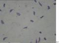 新生儿 女 牙龈黄豆大小肿物，质硬。临床：出生后两天变小，后面变小约4mm,蒂变细如线状。大家看看是什么？图5