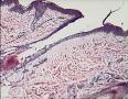 3岁，头左顶部病变，求助！！图14