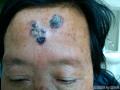 头部肿物来源？图1