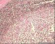 腹股沟淋巴结图5