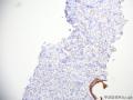 前列腺穿刺图6