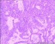 子宫内膜图6
