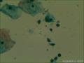 40倍镜头下拍照，大家看图中是不是有几个滴虫。图1