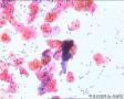 TCT。是放线菌吗？图6