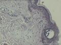 纤维瘤病？还是炎症？图9