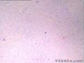 请会诊：右额叶肿瘤（形态典型）图12