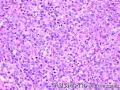 Lymph node, inguinal图6