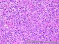 Lymph node, inguinal图4