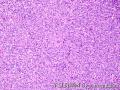 Lymph node, inguinal图5