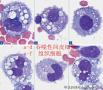 各种间皮细胞总结，只用于交流学习，提高脱落细胞学水平图2