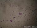 胸腔积液图4