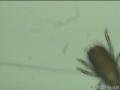 子宫肌瘤切片中发现虫子一个，是什么虫？图8