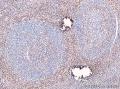 这个滤泡有问题吗？图5