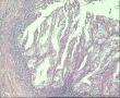 这几地方够子宫内膜癌吧，请帮助图4