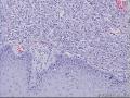 有个截肢的手标本，想请各位老师和同仁看看图6