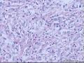 有个截肢的手标本，想请各位老师和同仁看看图16