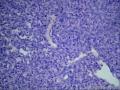 直肠系膜囊肿-上海市骨与关节肿瘤读片2013（2-8）-同济大学附属同济医院提供图2