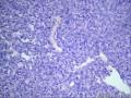 直肠系膜囊肿-上海市骨与关节肿瘤读片2013（2-8）-同济大学附属同济医院提供图3