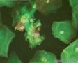 【优纳杯】征集00011——心花怒放（HSIL给予的美丽）图5