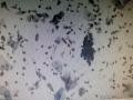 非典型腺细胞？ASC-H?异常子宫内膜细胞团？图20