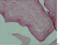 浆液性囊腺瘤？还是囊肿？图2